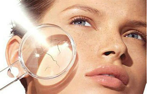 Ƥ��ɹ����ô�� Ƥ��ɹ�˺��޸���ʩ